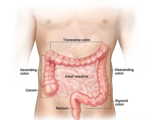 Colon cancer screening procedure